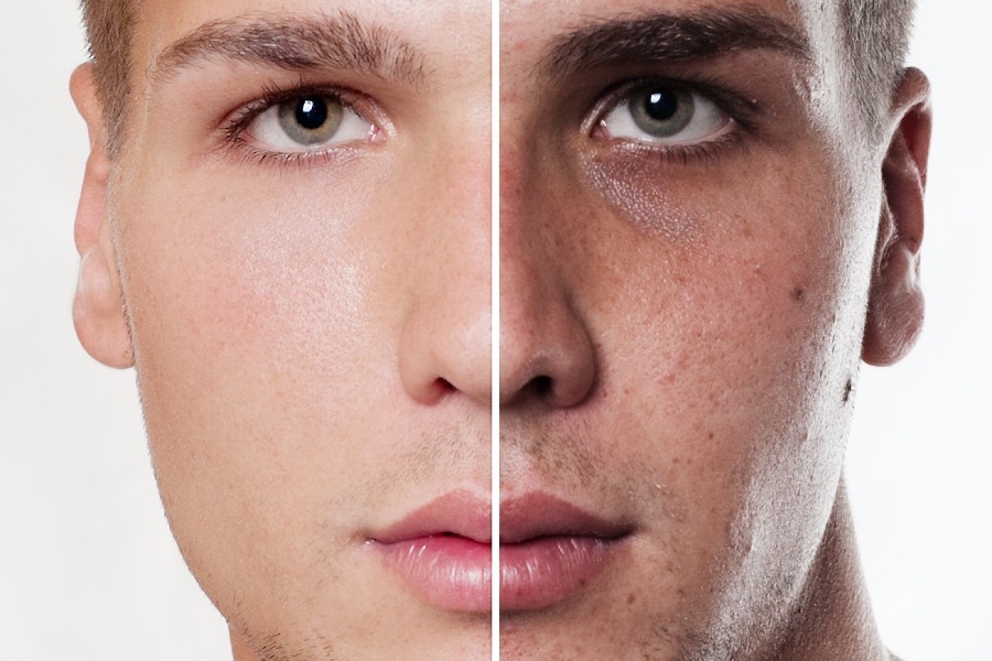 برای روشن شدن پوست صورت چه کنیم؟